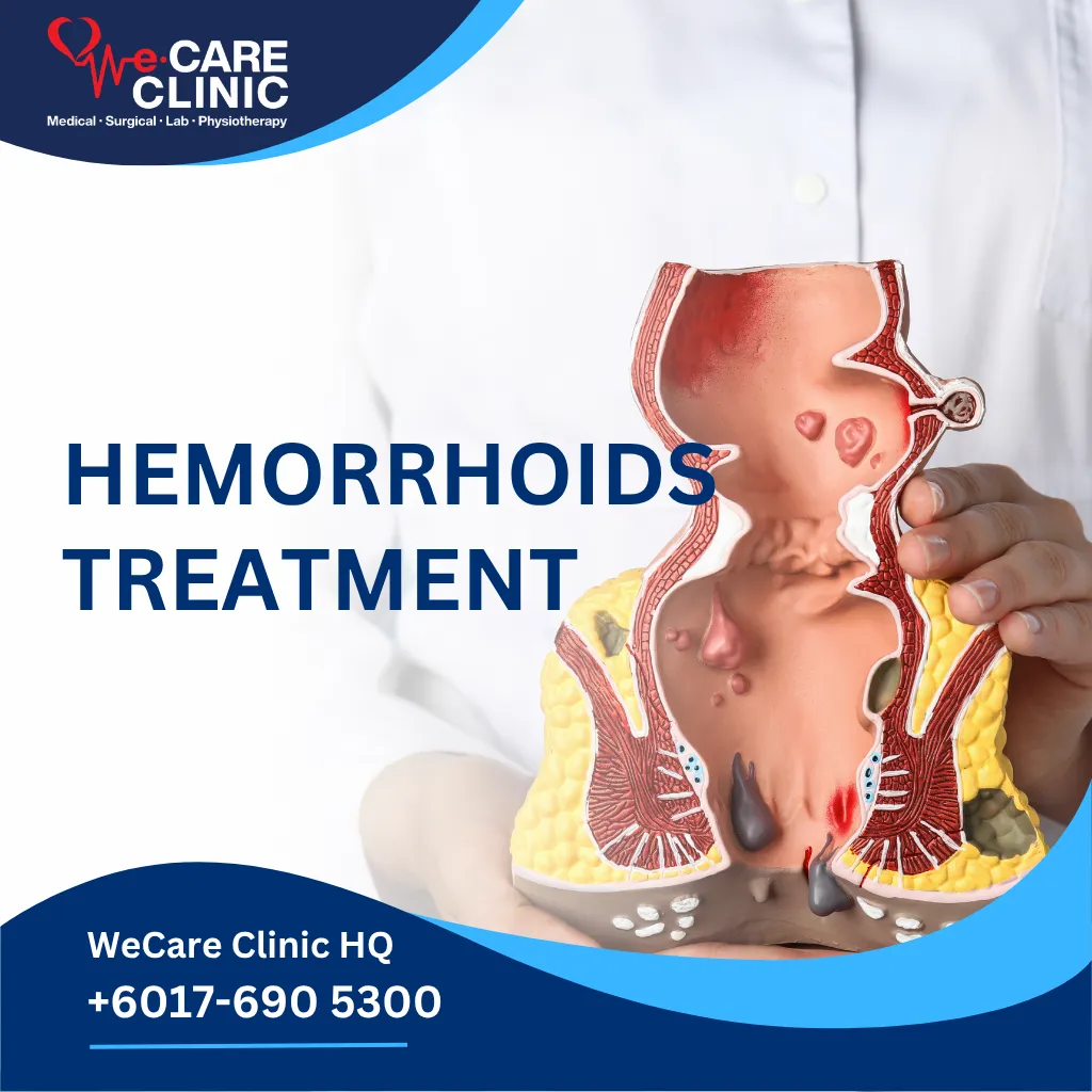 When Haemorrhoid Symptoms Need Medical Assessment